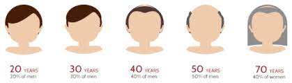 As a standardized extract, you can try 40 to 80 milligrams three times daily. Hair Loss Cantabria Labs