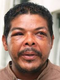 Six cops were hauled to the Magistrates&#39; Court to face charges of Wounding for allegedly beating thirty-five year old Elvin Torres after the checkpoint at ... - Elvin-Torres-225x300