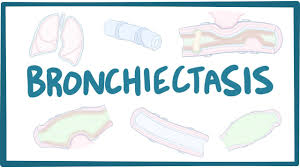 Image result for Bronchiectasis