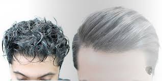 Nobody likes hair thinning and hair loss. Is Keratin Treatment Good For Thin Hair Ahs India