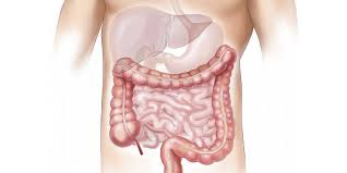 Although it is slightly more common in men, 1 in every 24 women will be diagnosed with colon or rectal cancer at some point in her life. What Is Colon Cancer Uew Healthcare