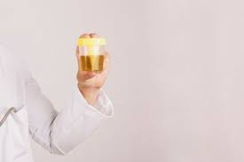 Maybe you would like to learn more about one of these? Warna Urine Ibu Hamil Lebih Gelap Dari Biasanya Waspadai Penyakit Penyakit Berisiko Ini Semua Halaman Nakita