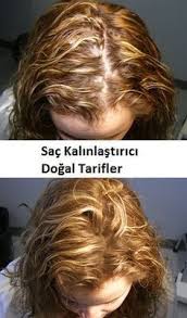 Daha Kalin Saclara Sahip Olmak Icin Dogal Tarifler Thick Hair Styles Thin Hair Care Healthy Hair Care