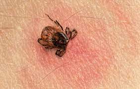 How To Remove A Tick From Your Balls - How To Get Rid Of Ticks