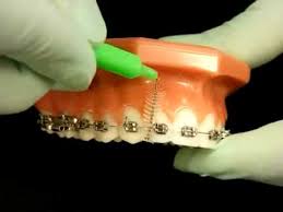 The following points will help make your child's daily brushing routine effective: Bracesquestions Com Brushing With Braces How To Brush Teeth Youtube