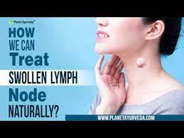 How We Can Treat Swollen Lymph Node Naturally - Youtube