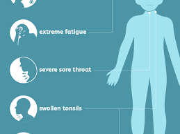 These symptoms include weakness and fatigue. Mononucleosis Signs Symptoms And Complications