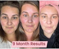 💎𝚂𝙴𝙸𝙽𝚃 𝐌𝐚𝐭𝐮𝐫𝐞-𝐒𝐤𝐢𝐧 𝙼𝙰𝙺𝙴𝚄𝙿 and Riman Skincare By  Jewel💎