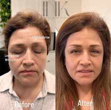 Brow services in Temecula, CA