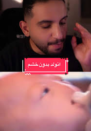 قصة إنسان ولد بدون خشم وتأثيرها على حياته