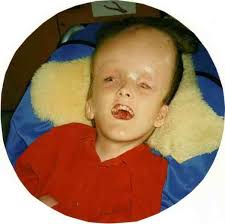 Does Alexander Forbes School accept kids with special needs and provide  adequate support?