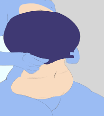 Anselme: Titty drop (Sangerla)