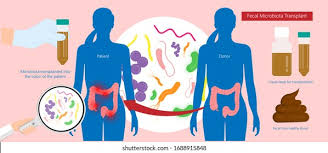 Image result for Fecal Transfer