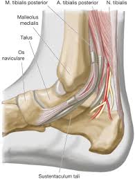 The medial malleolus is at risk for fracture regardless of the type of implant used, but more so with the agility prosthesis, for which a vertical cut is made in. Weichteile Verletzungen Und Chronische Schaden Springerlink