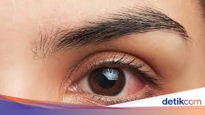 We did not find results for: 5 Obat Sakit Mata Alami Serta Penyebabnya