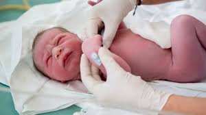 Suhu badan normal untuk bayi. 5 Masalah Kesehatan Yang Sering Dialami Bayi Baru Lahir Kumparan Com