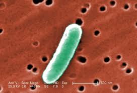 If you have bloody diarrhea, see your doctor as soon as possible. Escherichia Coli Principais Caracteristicas Da Escherichia Coli