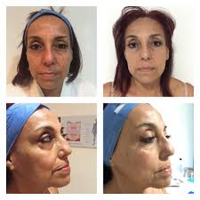 Nutrición & Estética