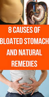 8 Causes Of Bloated Stomach And Natural Remedies Bloated Stomach Bloated Stomach Causes Stomach Remedies