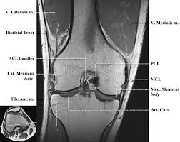 · 5, sartorius muscle and tendon. Http Www Smartview Co Wp Content Uploads 2014 02 Imagen Mr Normal Anatomia Rodilla Pdf