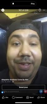 Idiopathic scoliosis: debunking myths and understanding connections