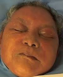 Carmel Daniels Unclaimed Person from Queens, New York