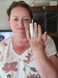 Arowana bit woman's nose while resting by pond