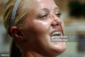 444 Scars 4 Stock Photos, High-Res Pictures, and Images