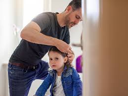 Image result for lice vs dandruff
