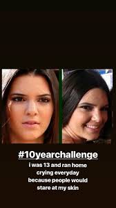 El dramático #10YearChallenge de Kendall Jenner