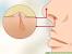 Hairy Nose