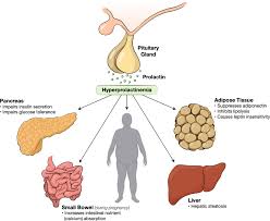 Image result for Hyperprolactinemia