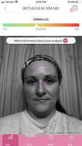 Hey Facebook friends!! No needles product that's erasing wrinkles! Note the  purple lines