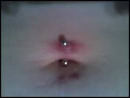 The Start Of An Infection In This Navel Piercing From Overcleaning With The Wrong Aftercare Products Belly Button Piercing Piercing Navel Piercing