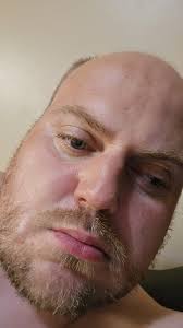 Grow a beard then shave it off and live happily ever after. Yeah except you  forgot the part where I kick your butt.