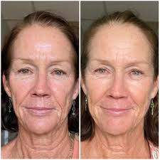 Dr. Paige Yang, L.Ac & DACM