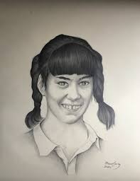 Phelan-McDermid Syndrome