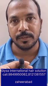 #sadasivpet #bidar #sangareddy #zaheerabad #humnabad