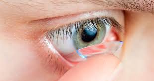 For example, some contact lenses may. Scleral Contact Lenses For Keratoconus And Irregular Corneas