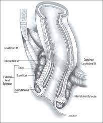 Pelvic Floor Dysfunction Expanded Version Ascrs