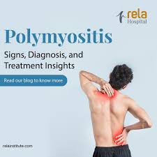 Image result for Polymyositis