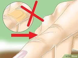 How To Treat A Paper Cut (With Pictures) - Wikihow