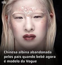 Quando Xueli era bebê, seus pais a deixaram no chão do lado de fora de um  orfanato. Na China, o albinismo é visto por alguns como uma maldição Veja  as fotos ⬇️