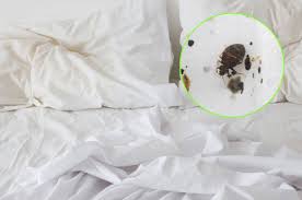 Bettwanzen Im Hotel Erkennen Und Bekampfen Wichtige Tipps Travelbook