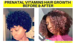 See Prenatal Vitamins Hair Growth Before And After Pictures Now