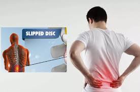 Buah pinggang yang sihat mengeluarkan sejenis hormon yang dikenali sebagai erythropoietin atau sakit buah pinggang sangat merisaukan. Awasi Kondisi Belakang Bila Memandu Lama Punca Utama Berlakunya Slipped Disc Maskulin