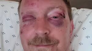 Fundraiser for Adam Theo by Luca Gattoni-Celli : Help Theo back