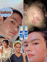 nyinyiwin memposting kontribus