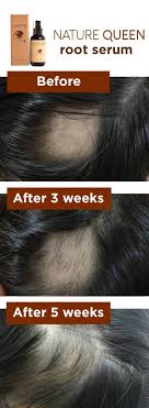 Anti Aging Root Nourishing Serum With Images Promote Healthy Hair Growth Thick Hair Solutions Grow Hair Faster