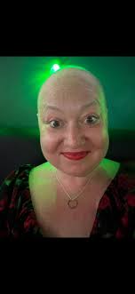 Fundraiser for Alli Ellis by Rachel Robisheaux : Support Alli's Battle  Against Metastatic Cancer